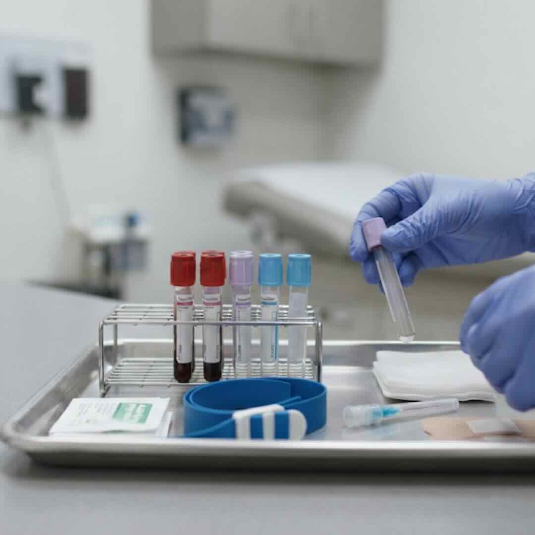 On-Site-Lab-Draw-Noorani-Medical-Center-Riverview-FL Blood draw tray prepared for an on-site lab test at Noorani Medical Center in Riverview, FL