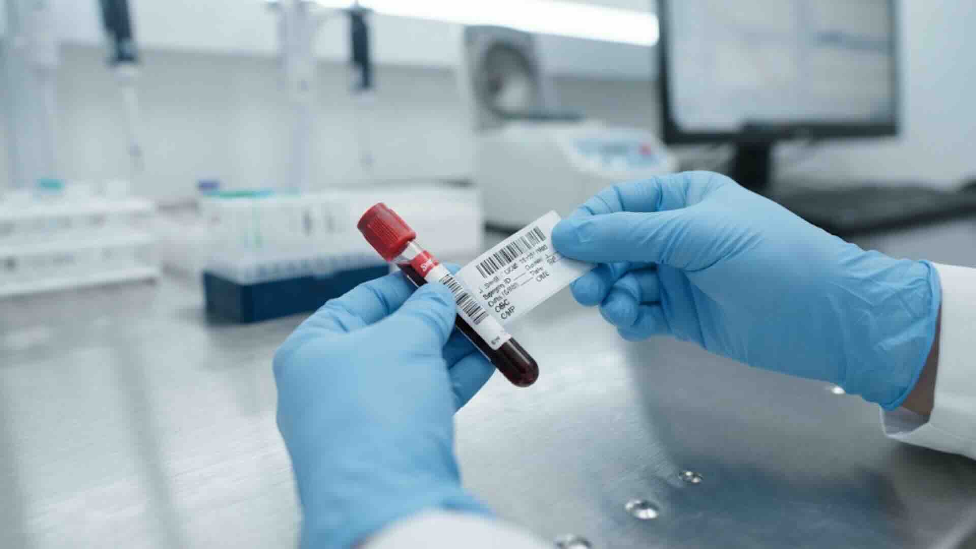 Lab technician labeling a blood sample vial for a type 2 diabetes A1C test
